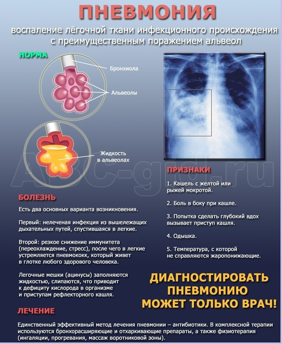 Профилактика внутрибольничных пневмоний.